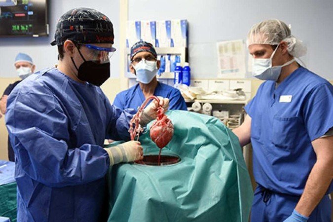 1_heart_transplant_surgery2-33205983